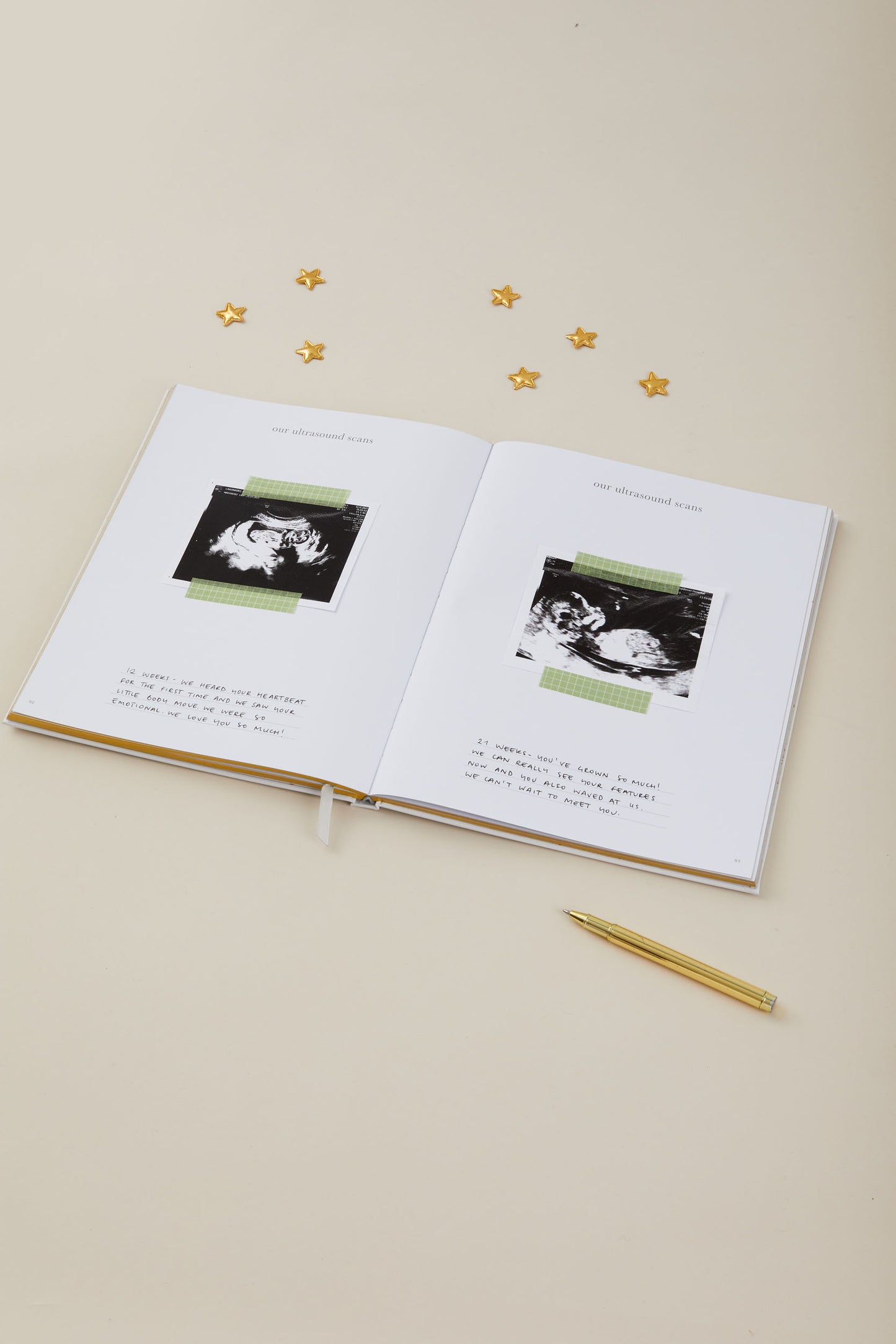 Pregnancy Journal (Grey)