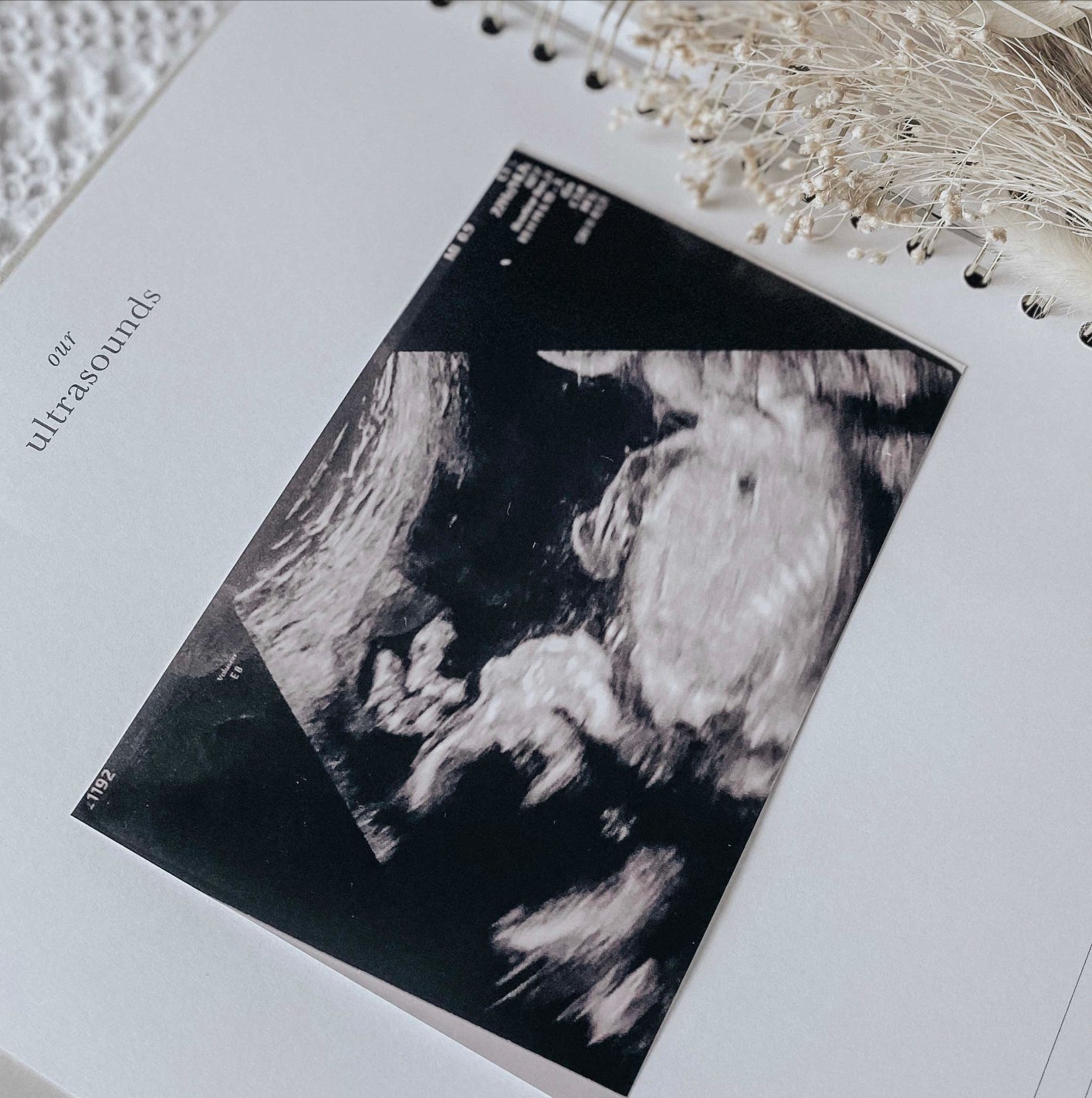 My Baby Book - Baby Memory Book - White